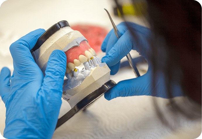 Gloved hands adjusting dental prosthetic model
